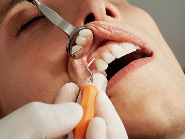 angst tandarts rotterdam